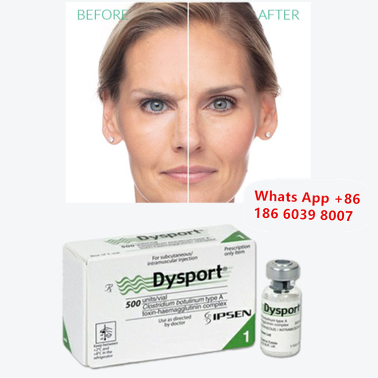 Dysport Botulinum Toxin Type A Injection for Wrinkle Reduction