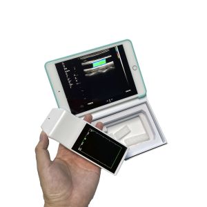 Wireless Linear Probe High Frequency Probe Special Tool for Visual Puncture Guidance Integrated Handheld Ultrasound Scanner