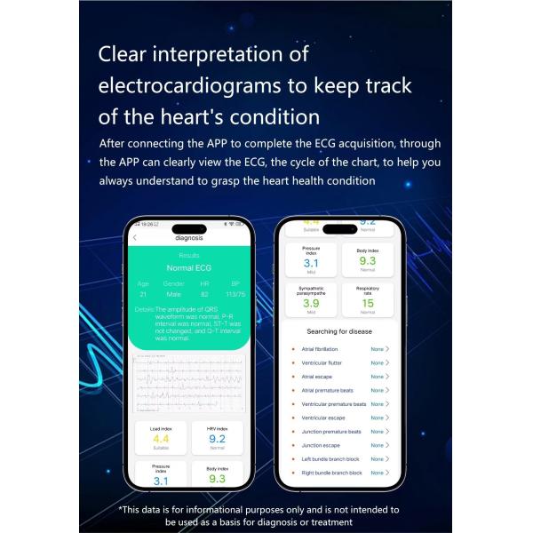 S26 Smart Watch 1.43 Inch AMOLED BT Calling Air Pump Blood Pressure Monitor SmartWatch