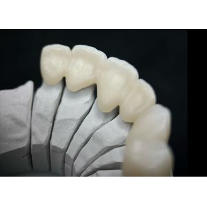 Dental Solid Zirconia Crown Ombining Outstanding Strength And Natural Aesthetics