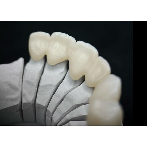 Buy Dental Solid Zirconia Crown Ombining Outstanding Strength And Natural Aesthetics at wholesale prices