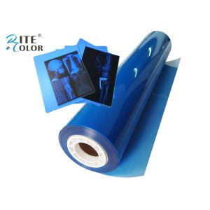 Inkjet Blue Radiology Medical Imaging Film