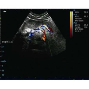 Full Digital Color Doppler Machine System Angle Adjustable Ultrasound Scanner