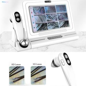 Digital Scalp Analyzer for Home Portable Scalp Scanner Detector Head Target Area