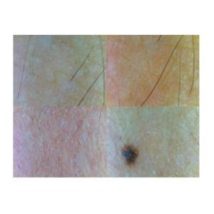 Skin Testing Device Video Dermatoscope with 4 Kinds of Skin Status Reports Wifi