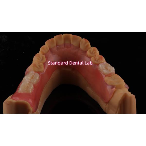 High Esthetics Dental TCS Valplast Flexible Partial Dentures Dental Lab pink shade