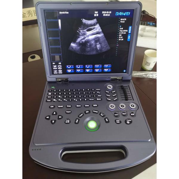 Buy CE Portable Ultrasonic Diagnostic System 4d Color Doppler Ultrasound 300mm at wholesale prices