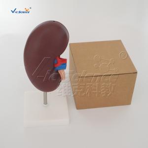 Medical Science Human Body Anatomy Model Human Kidney Model 20x10x7CM