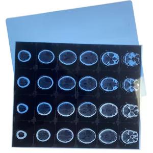 Sheet Blue Xray Film Inkjet Medical Dry Film Clear Image
