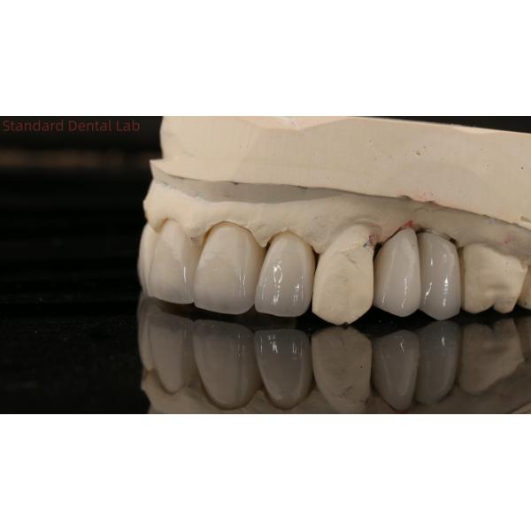 China Dental Lab Zirconia Full Contour Crown High Aesthetic Natural Dental Bridge 5 Year Guarantee