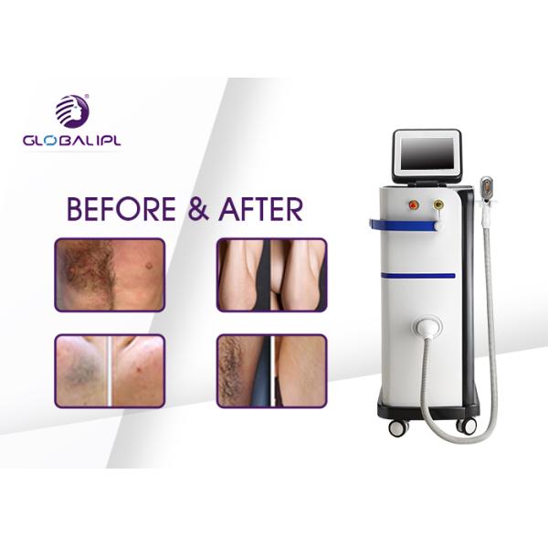 AC 220V SHR 3500W 120J/Cm2 808nm Hair Removal Equipment
