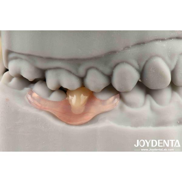 Buy Flexible Denture Finish Personalized Customization and Advanced Tooth Arrangement Technology for Customized Needs at wholesale prices