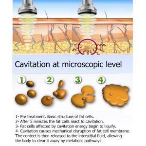 5 In 1 Multifunctional 40k 80k Vacuum Cavitation System Rf Lipo Laser Weight