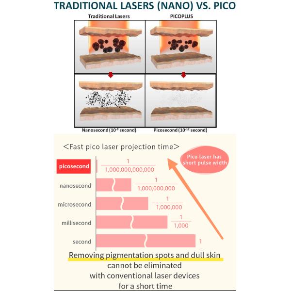 Nd Yag Tattoo Removal Carbon Peel Skin Care Picolaser Machine Q Switched