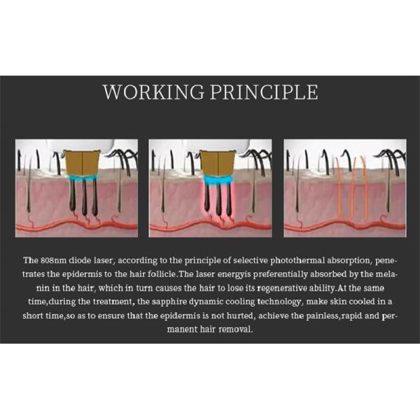 3 Wavelength Diode Laser Hair Removel Equipment 808nm 755nm 1064nm