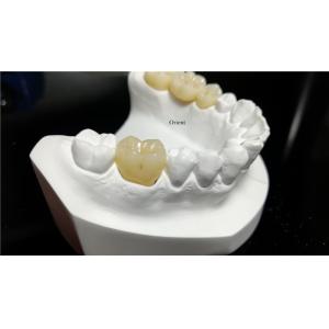 Ceramic Dental Crown,Zirconia Dental Crowns