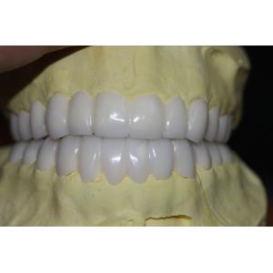China Temporary PFM Dental Crown on sale