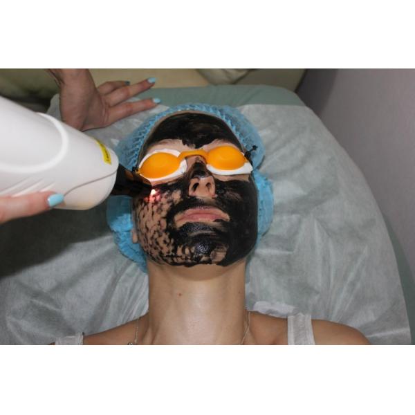 SQ-2 1064nm 532nm nd:yag laser tattoo removal machine/nd:yag laser q switch/portable q switch nd yag