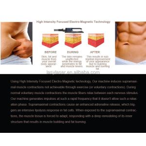 Circslim Aesthetics Body Sculpting Machine , Tesla Hiemt Body Sculpt Machine
