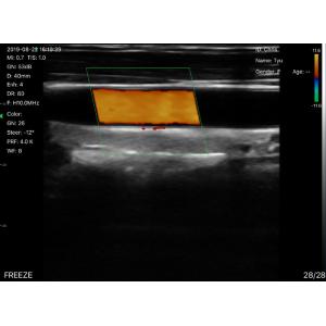 Wifi Ultrasound Probe Convex Linear Phasedarray 80/128/192 Color Doppler