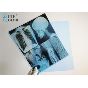 Inkjet Blue Radiology Medical Imaging Film