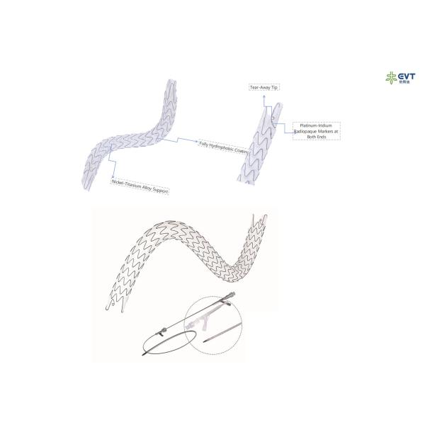 Buy Large Lumen Urethral Stent Hydrophobic Nitinol Design For Precision Placement at wholesale prices