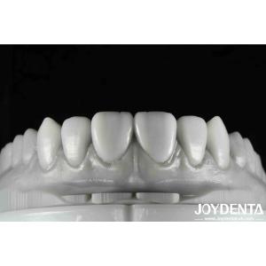 Flexible Denture Finish Revolutionize Your Dental Practice With Natural Tooth