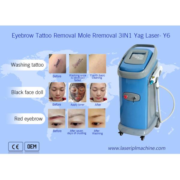 Buy 1064nm 532nm Nd Yag Laser Tattoo Removal Machine Dermatology at wholesale prices
