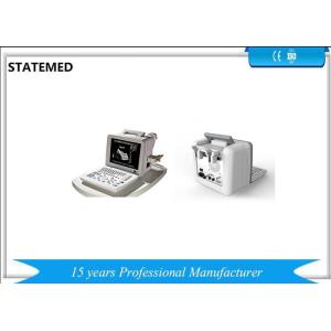 2D High Definition Image Portable Ultrasound Scanner With Convex Probe