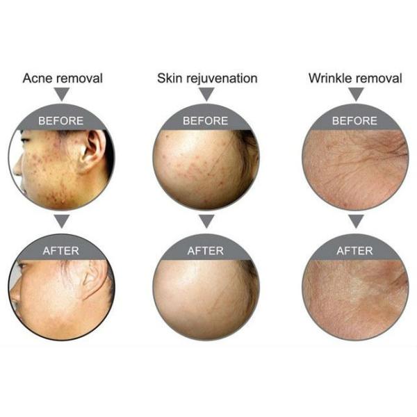 Permanent IPL Hair Removal Equipment Multifunction Beauty Machine