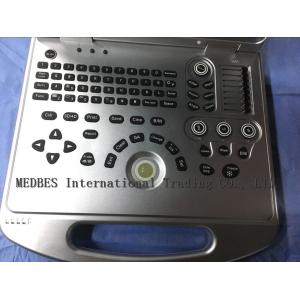 Ce Hospital Equipment Medical Diagnostic Ultrasounic Machine Digital Laptop