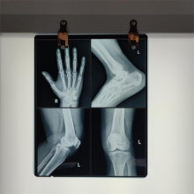 Quality Low Fog Level Medical X Ray Blue Film 200±5μM High Sharpness for sale