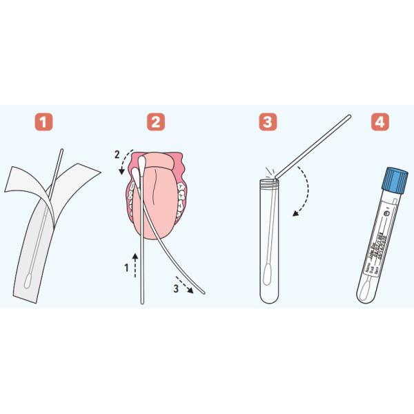 SARS-CoV-2 Antigen Rapid Test for COVID-19 Coronavirus 2, diagnosis of COVID-19 pandemic within 15mins