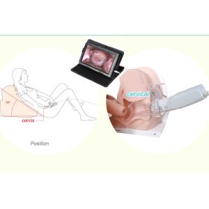 Self - Inspection Tool for Cervical Examination Digital Electronic Colposcope