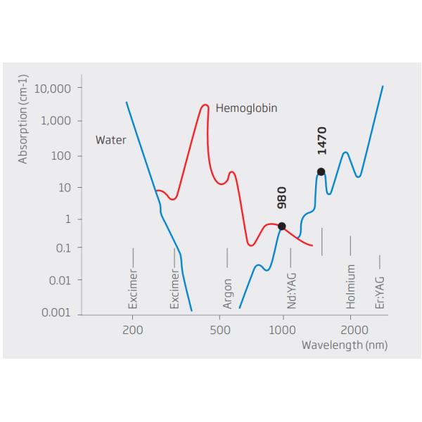 30W Cherylas 1470nm Laser Disc Decompression For Disc Bulge