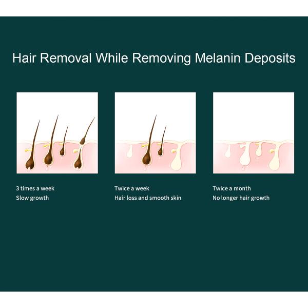 Freezing Point Laser IPL Hair Removal Epilator 990000 Flashes Home Use Portable Ice Cool Painless Hair Remove Device Dep