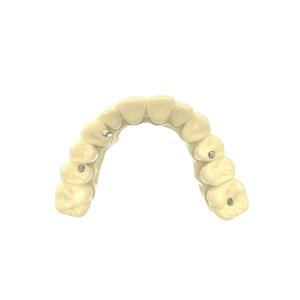 Dental Bridge Resin Biocompatible 3d Printing Resin