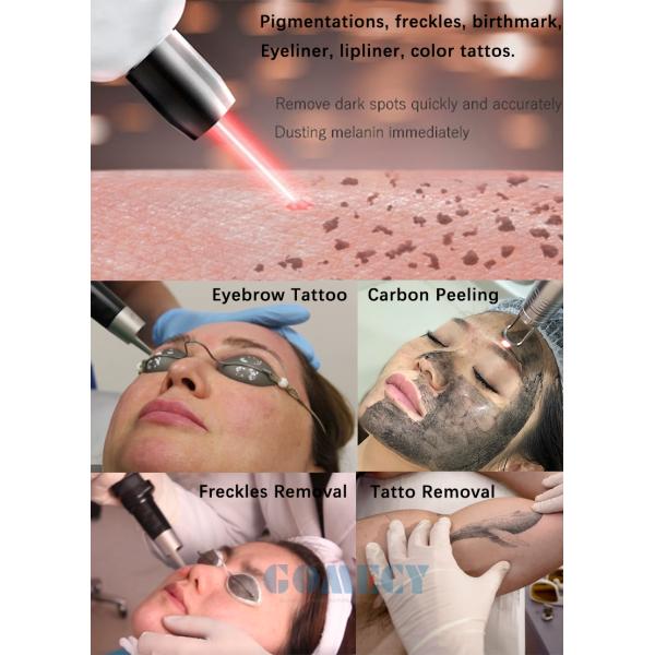 Nd Yag Tattoo Removal Carbon Peel Skin Care Picolaser Machine Q Switched