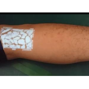 Handheld Lightweight Infrared Vein Finder with Optional wheeled or Fixed stands