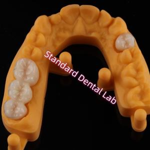 Crown All Porcelain Ceramic Zirconia Ivoclar Esthetic Teeth OEM