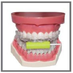 High Quality Dental Aligner Chewies Disposable Aligner Chewies