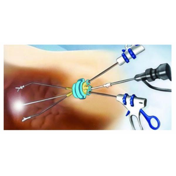 RF Plasma Gyn Electrode , Disposable Probe