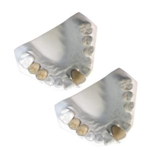 China Good Mechanical Porcelain Metal Crowns Yellow Gold High Strength on sale