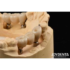 Zirconia Implants Perfect Match With Natural Teeth Zero Allergy Risk