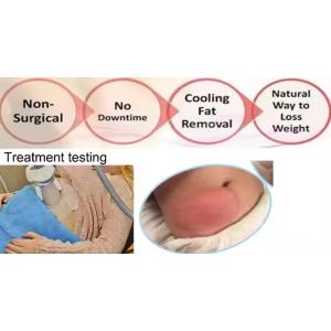 Cryolipolysis Vertical 4 Handles Multifunctional Body Shape 360 Cool Cryolipolys