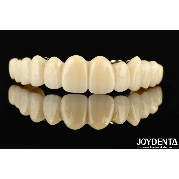Buy Custom-made Ti-Bar Zirconia Hybrid Bridge The Perfect Combination For Comfort And Functionality at wholesale prices