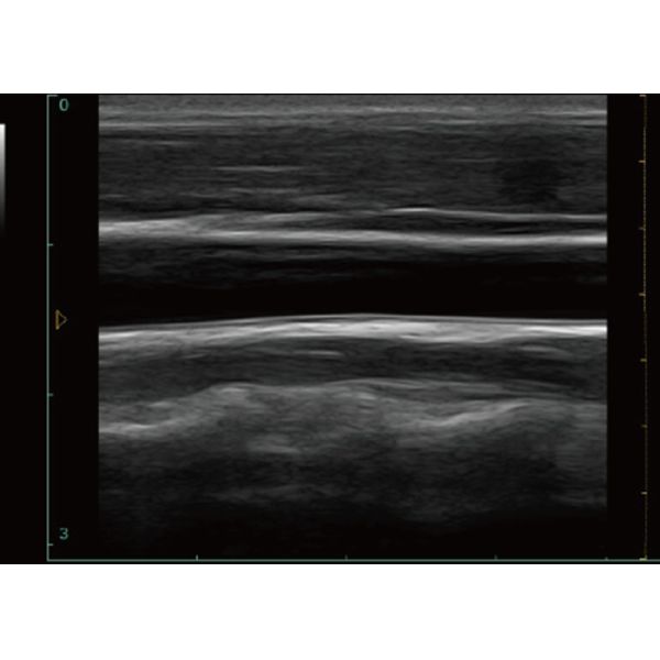 256 Frame Cine Portable Ultrasound Scanner 128 Permanent Storage With 12 Inch Screen