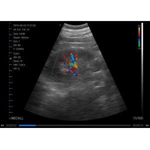 IOS Android Windows Handheld Portable Ultrasound Device Convex Linear Cardiac 3