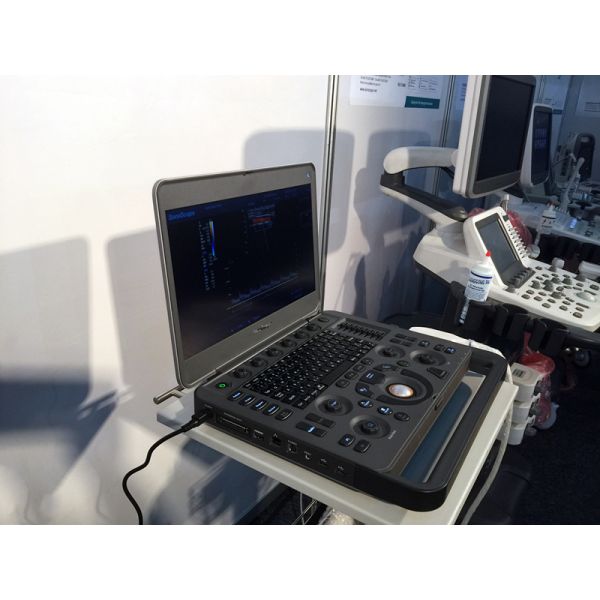 Sonoscape X5 Medical Ultrasound Instruments Machine with Excellent Image Quality