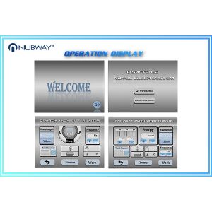 Nubway cheap laser yag q switched nd yag laser tattoo removal machine price with